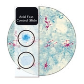 Acid Fast Stain Control Slides